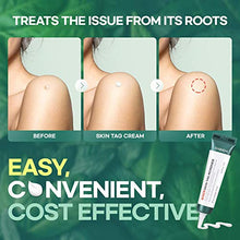 Load image into Gallery viewer, Skin Tag Remover Cream for Safe & Effective Skin Tag Removal, Natural Ingredients, Korean Skin Care