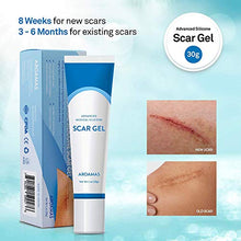 Load image into Gallery viewer, Aroamas Advanced Scar Gel Medical-Grade Silicone for Face, Body, Stretch Marks, C-Sections, Surgical, Burn, Acne, Old & New Scars, Clinically Proven, 30g