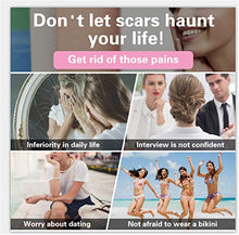 Load image into Gallery viewer, Lancs Acne Scar Removal Serum Skin Repair Essence for Reduces the Appearance of Old & New Scars, Wrinkles, Burns and Recovery Scar Treatment (5ml7 bottles)