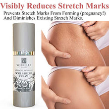 Load image into Gallery viewer, Scar & Bruise Removal Cream - Best Treatment Remedy for Healing, Skin Repair, Fading & Prevention of Old or New Acne & Stretch Mark, Surgical, Keloid, C Section, Pregnancy or Bug Bite Scars & Bruises