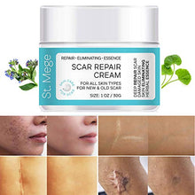 Load image into Gallery viewer, Scar Removal Cream, Scar Cream For Old Scars - Stretch Mark Removal Cream for Men & Women - Stretch Marks Relief and Burns Repair, Face Skin Repair Cream