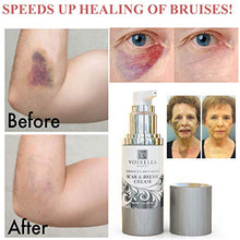 Load image into Gallery viewer, Scar & Bruise Removal Cream - Best Treatment Remedy for Healing, Skin Repair, Fading & Prevention of Old or New Acne & Stretch Mark, Surgical, Keloid, C Section, Pregnancy or Bug Bite Scars & Bruises