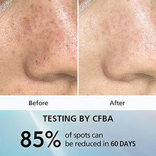 Load image into Gallery viewer, MECMOR Dark Spot Facial Treatment Mask with Arbutin Vitamin C Hyaluronic Acid, Reduce Dark Spots Pigmentation Acne Marks, Hydrating Antiaging Sheet Masks for Sensitive Blemished Skin, 5 Pcs Merry Christmas Gift Happy New Year