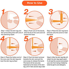 Load image into Gallery viewer, Skin Tag Remover, Skin Tag Removal Kit with 36 PCS Skin Tag Repair Patches, Efficient Skin Tag Remover Kit for Medium to Large Skin Tags