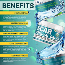 Load image into Gallery viewer, Scar Removal Cream - Effective Stretch Mark Removal - Natural Skin Repair - Acne Scar Remover Cream - Made in USA - Advanced Treatment for Old Scars & Acne Scars - Clinically Proven Formula - 2 OZ