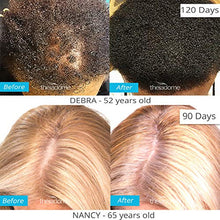 Load image into Gallery viewer, Theradome PRO LH80 - Medical Grade Laser Hair Growth Helmet - FDA Cleared for Men & Women. Promotes Hair Regrowth and Prevents Further Hair Loss with Premium Red Light Lasers