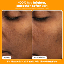 Load image into Gallery viewer, Paula's Choice Brighter Days Ahead Kit, Vitamin C and AHA Trio, Includes Travel Size C5 SPF Face Sunscreen, Mandelic Acid Exfoliant, C15 Vitamin C Booster Serum, Brightening &amp; Resurfacing, 3-Piece Set
