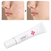 Load image into Gallery viewer, 15g Acne Removal Cream, Moisturizing Acne Scars Treatment Cream Skin Repairing Cream, Fades Acne Spot, stubborn Scars, Pigmentation &amp; Blemish
