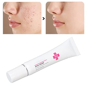 15g Acne Removal Cream, Moisturizing Acne Scars Treatment Cream Skin Repairing Cream, Fades Acne Spot, stubborn Scars, Pigmentation & Blemish