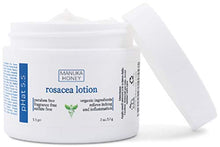 Load image into Gallery viewer, Rosacea Red Skin and Acne Cream - with Manuka Honey, Aloe Vera &amp; Coconut Oil - Redness, Inflammation, Acne and Rosacea Relief - Paraben &amp; Sulfate Free (2 oz)

