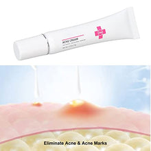Load image into Gallery viewer, 15g Acne Removal Cream, Moisturizing Acne Scars Treatment Cream Skin Repairing Cream, Fades Acne Spot, stubborn Scars, Pigmentation &amp; Blemish
