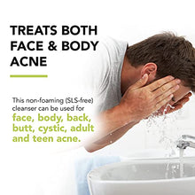 Load image into Gallery viewer, Humane Maximum-Strength Acne Wash - 10% Benzoyl Peroxide Acne Treatment for Face, Skin, Butt, Back and Body - 8 Fl Oz - Dermatologist-Tested Non-Foaming Cleanser - Vegan, Cruelty-Free
