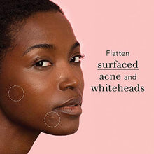 Load image into Gallery viewer, Rael Acne Pimple Healing Patch - Absorbing Cover, Invisible, Blemish Spot, Hydrocolloid, Skin Treatment, Facial Stickers, Two Sizes 10mm &amp; 12mm, Blends in with skin (96 Count)
