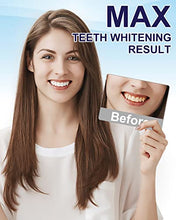 Load image into Gallery viewer, MySmile Teeth Whitening Kit Enhanced Teeth Whitener Flagship Version,10 Min 6 Month Supply Non-Sensitive Teeth Whitening Pen, Helps to Remove Stains from Coffee, Smoking, Wine, Soda, Tea

