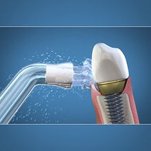 Load image into Gallery viewer, Waterpik Whitening Water Flosser Replacement Tip, Plaque Seeker, 2 Count
