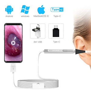 Ear Specula Set for ScopeAround/Anykit Digital Otoscope Ear Wax Removal Camera, Bag of 100 Pices