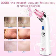Load image into Gallery viewer, Blackhead Remover Pore Vacuum - Electric Blackhead Vacuum Cleaner Blackhead Extractor Tool Device Comedo Removal Suction Beauty Device for Women（Pink)
