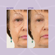 Load image into Gallery viewer, Beverly Hills Instant Facelift and Eye Serum Treatment for Dark Circles, Puffy Eyes, and Wrinkles
