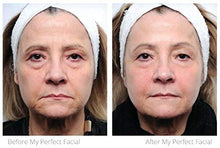 Load image into Gallery viewer, My Perfect Facial Best Instant Anti-Ageing Face-Lift, Tones, Tightens and Firms Sagging Skin with Beta Hydroxy Acids, Enzymes and Collagen, Salon Grade Results, 5 Treatment Kit
