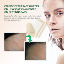 Load image into Gallery viewer, Aroamas, Silicone Scar Removal Sheets - for Keloid, C-Section, Hypertrophic, Surgical Scars and More Reusable and Washable 3&quot;×1.57&quot;, 4 Sheets (2 Month Supply)
