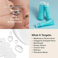 Load image into Gallery viewer, Paula's Choice CLEAR Extra Strength Acne Kit, 2% Salicylic Acid &amp; 5% Benzoyl Peroxide for Severe Acne, Redness Relief, PACKAGING MAY VARY
