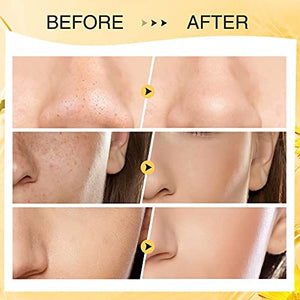 Turmeric Clay Stick Mask Organic Vitamin C Purifying Clay Mask Blackhead Cleansing Healing Clay Mud Mask Deep Clean Pore Improve Skin Acne Scars Facial Mask With Blackhead Remover Extractor ToolS