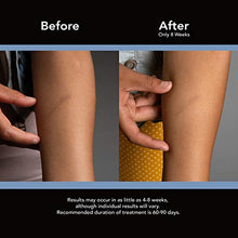 Load image into Gallery viewer, ScarAway Advanced Skincare Silicone Scar Sheets for Face, Body, Surgical, Burn, Hypertrophic Scars, Keloids and Acne Scar Treatment, 12 Sheets
