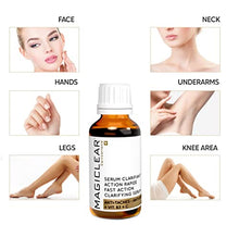 Load image into Gallery viewer, Luxury Dark spot remover for Face and Body Serum - Age spot corrector Acne scar - Anti aging - Bleaching Vitamin C organic Swiss brand Magiclear 30 ml
