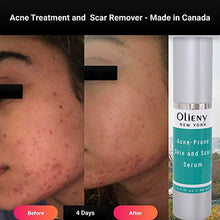 Load image into Gallery viewer, Acne spot Treatment Skin Serum Vitamin C, E and niacin amide Vitamin B3, B5, Acscanex for scars remove 50ML plus Face Cleanser 120Ml FREE
