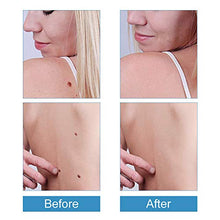Load image into Gallery viewer, Skin Tag Removal Patches,Skin Tag Remover Patches,Skin Tag Removal,Skin Tag Acne Remover Patches,Mole Remover Patches,Cover and Conceal Skin Tags
