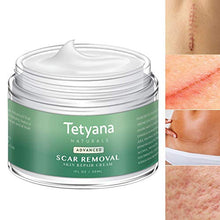 Load image into Gallery viewer, Scar Removal Cream Advanced Treatment for Old &amp; New Scars from Cuts Stretch Marks, C-Sections &amp; Surgeries With Natural Herbal Extracts Formula
