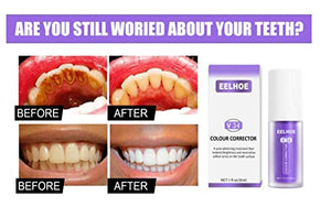 2 PCS V34 Colour Corrector Teeth Whitening Sensitive Teeth Toothpaste, Intensive Stain Removal Teeth Reduce Yellowing （Purple）