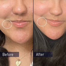 Load image into Gallery viewer, PanOxyl Acne Foaming Wash Benzoyl Peroxide 10% Maximum Strength Antimicrobial, 5.5 Oz
