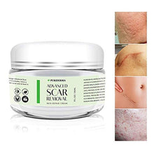 Load image into Gallery viewer, Scar Removal Cream - Advanced Treatment for Face &amp; Body, Old &amp; New Scars from Cuts, Stretch Marks, C-Sections &amp; Surgeries - With Natural Herbal Extracts Formula
