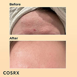 COSRX Snail Mucin 96% Power Repairing Essence 3.38 fl.oz, 100ml, Hydrating Serum for Face with Snail Secretion Filtrate for Dark Spots and Fine Lines, Not Tested on Animals, No Parabens, No Sulfates, No Phthalates, Korean Skincare