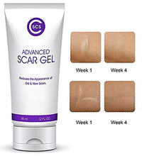 Load image into Gallery viewer, CSCS Most Effective Scar Remover Cream with Hydrolyzed Collagen &amp; Vitamin E - Heals Old &amp; New Scars from Cuts, Acne, Stretch Marks, Burns &amp; Post Surgeries Scars - Fast Results, for All Skin Types 2 oz
