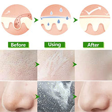 Load image into Gallery viewer, Aloe Vera Peel Off Blackhead Remover Mask - Peel Off Face Masks Whitehead Removal, Aloe Vera Extract Facial Mask, Oil Control Cleaning Face - Facial Moisturizing, Moisture Skin

