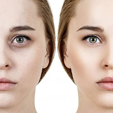 Load image into Gallery viewer, Dark Circles Under Eye Treatment for Women Men | Puffiness | Bags Under Eye | Dark Circle | Wrinkles | RF High Frequency Facial Under Eye Massager Machine, High Frequency Facial Under Eye Machine
