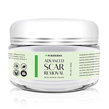 Load image into Gallery viewer, Scar Removal Cream - Advanced Treatment for Face &amp; Body, Old &amp; New Scars from Cuts, Stretch Marks, C-Sections &amp; Surgeries - With Natural Herbal Extracts Formula
