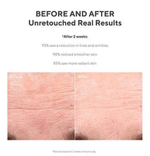 Load image into Gallery viewer, Murad Resurgence Lines and Wrinkles Bundle ($174 Value) with Retinol Youth Renewal Eye Serum (0.5 oz) and Retinol Youth Renewal Serum (1 oz)
