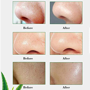 Blackhead Remover Mask, Blackhead Peel off Mask, Peel off Face Masks, Aloe Vera Extract Facial Mask- Anti-Aging, Exfoliating Mask, Deep Cleansing Blackhead＆ Pore,Reduces Fine Lines＆ Wrinkles- 3.52 OZ