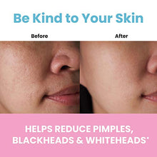 Load image into Gallery viewer, One Living Earth Collagen Facial Mask for Women - Collagen, Triple Action Clay &amp; Charcoal - 6oz
