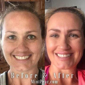 Collagen Peptides Face Serum 30 ml - Anti Aging Skin Care Facial Serum - Collagen Booster Tri Peptide Firming Serum | Wrinkles Reducer & Fine Lines Improves Elasticity