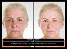 Load image into Gallery viewer, Vitamin C Serum &amp; Retinol Cream for Face Bundle - Natural &amp; Organic Anti Aging Skin Care Set for Men &amp; Women to Reduce Wrinkles and Dark Spots
