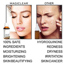 Load image into Gallery viewer, Luxury Dark spot remover for Face and Body Serum - Age spot corrector Acne scar - Anti aging - Bleaching Vitamin C organic Swiss brand Magiclear 30 ml
