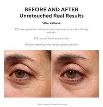 Load image into Gallery viewer, Murad Resurgence Lines and Wrinkles Bundle ($174 Value) with Retinol Youth Renewal Eye Serum (0.5 oz) and Retinol Youth Renewal Serum (1 oz)
