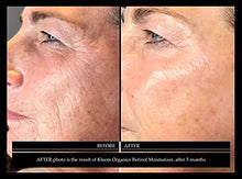Load image into Gallery viewer, Anti-Wrinkle Night Cream with 2.5% Retinol and Hyaluronic Acid - Anti Aging Retinol Moisturizer Cream for Men &amp; Women to Reduce Wrinkles &amp; Dark Spots
