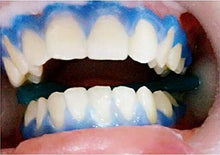 Load image into Gallery viewer, EZGO Teeth Whitening Gel Refills Cheek Retractor and Dental Gingival Barrier Protection Gel Combo, C-Shape Mouth Opener, Gum Protector Gel, Non-Sensitive Teeth Whitener Sets

