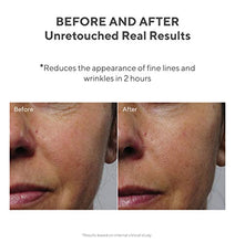 Load image into Gallery viewer, Murad Resurgence Rapid Collagen Infusion - Anti-Aging Collagen Serum for Skin - Collagen Cream for Face and Neck Smooths and Visibly Minimizes Wrinkles, 1.0 Fl Oz (Packaging May Vary)
