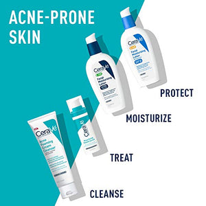 CeraVe Acne Foaming Cream Cleanser | Acne Treatment Face Wash with 4% Benzoyl Peroxide, Hyaluronic Acid, and Niacinamide | Cream to Foam Formula | 5 Oz